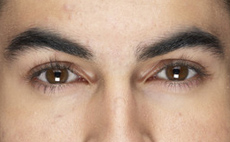 Pennsylvania lens solution lawyers - Philadelphia, Pennsylvania, New Jersey, Delaware - Eye infection lawyers
