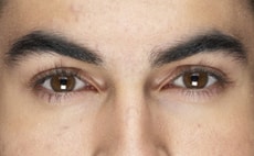 lens solutionsm