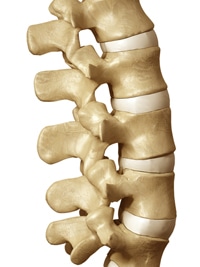 laser spine 0