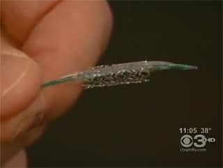 stents 0