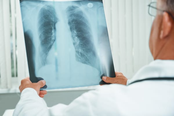 Unrecognizable older doctor examines x ray image