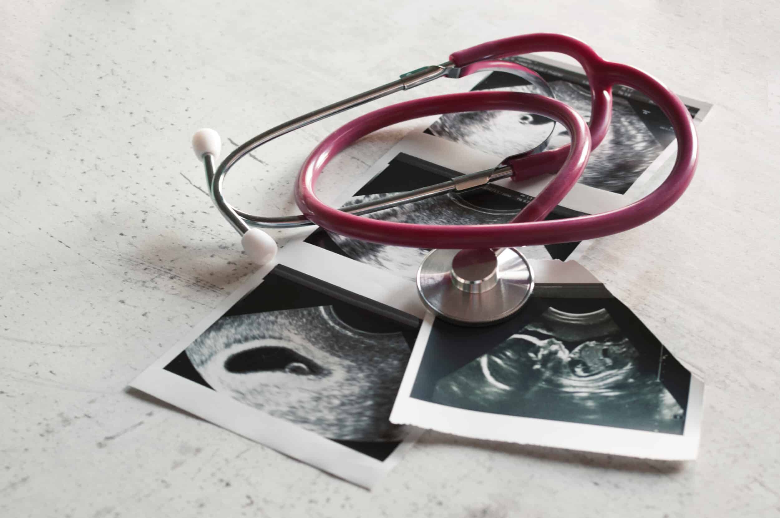 A stethoscope on top of ultrasound images