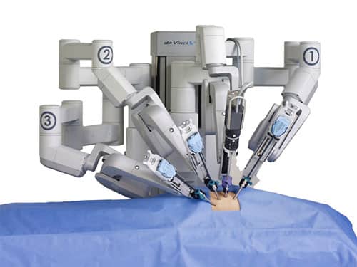 robot surgery