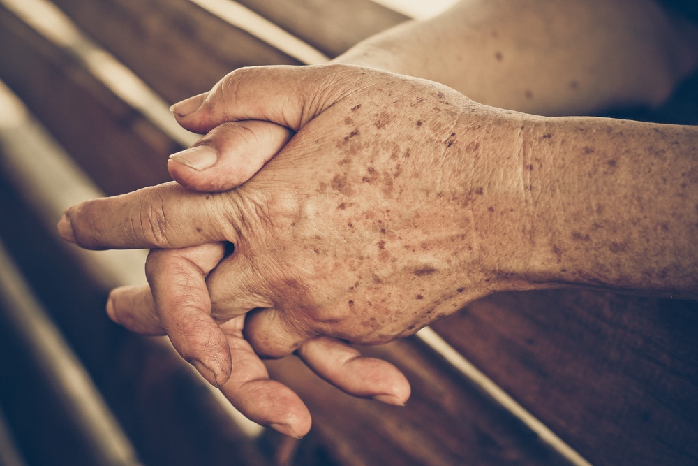 A close-up shot of a nursing home abuse victim’s hands